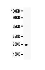 TRAIL Antibody in Western Blot (WB)