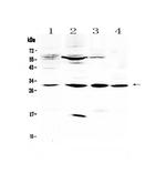 VEGFB Antibody in Western Blot (WB)