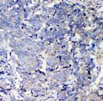 IQGAP2 Antibody in Immunohistochemistry (Paraffin) (IHC (P))