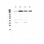 IQGAP2 Antibody in Western Blot (WB)