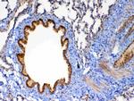 MMP13 Antibody in Immunohistochemistry (Paraffin) (IHC (P))