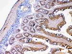 MMP13 Antibody in Immunohistochemistry (Paraffin) (IHC (P))