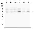 MMP13 Antibody in Western Blot (WB)