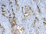 MUC1 Antibody in Immunohistochemistry (Paraffin) (IHC (P))