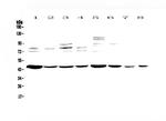 PDK2 Antibody in Western Blot (WB)