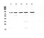 NOX4 Antibody in Western Blot (WB)