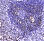 S100A10 Antibody in Immunohistochemistry (Paraffin) (IHC (P))