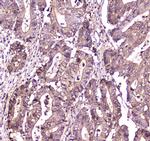 S100A10 Antibody in Immunohistochemistry (Paraffin) (IHC (P))