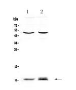 S100A10 Antibody in Western Blot (WB)