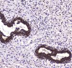 LC3A Antibody in Immunohistochemistry (Paraffin) (IHC (P))