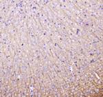 LC3A Antibody in Immunohistochemistry (Paraffin) (IHC (P))