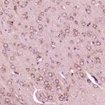 Calcitonin Antibody in Immunohistochemistry (Paraffin) (IHC (P))