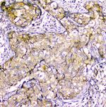 Creatine Kinase MM Antibody in Immunohistochemistry (Paraffin) (IHC (P))