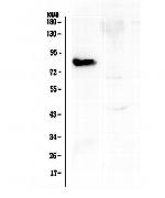 COMP Antibody in Western Blot (WB)