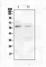 M-CSF Antibody in Western Blot (WB)