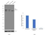 DDR2 Antibody in Western Blot (WB)