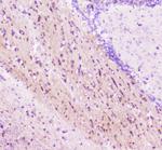 ELAVL2 Antibody in Immunohistochemistry (Paraffin) (IHC (P))