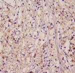 EML4 Antibody in Immunohistochemistry (Paraffin) (IHC (P))