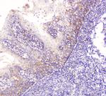 EML4 Antibody in Immunohistochemistry (Paraffin) (IHC (P))