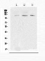 EML4 Antibody in Western Blot (WB)