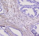 NSE Antibody in Immunohistochemistry (Paraffin) (IHC (P))