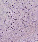 NSE Antibody in Immunohistochemistry (Paraffin) (IHC (P))