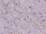 NSE Antibody in Immunohistochemistry (Paraffin) (IHC (P))