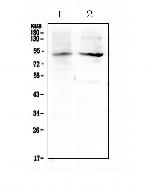 XPB Antibody in Western Blot (WB)