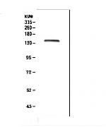 LRIG1 Antibody in Western Blot (WB)