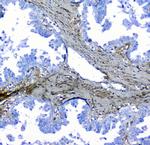 LUM Antibody in Immunohistochemistry (Paraffin) (IHC (P))