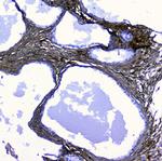 LUM Antibody in Immunohistochemistry (Paraffin) (IHC (P))