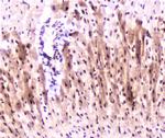 MEF2C Antibody in Immunohistochemistry (Paraffin) (IHC (P))