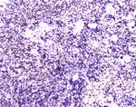 MEF2C Antibody in Immunohistochemistry (Paraffin) (IHC (P))