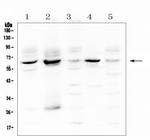 METTL3 Antibody in Western Blot (WB)