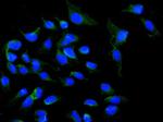 NOX5 Antibody in Immunocytochemistry (ICC/IF)