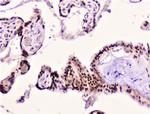 RAD51 Antibody in Immunohistochemistry (Paraffin) (IHC (P))