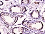 RAD51 Antibody in Immunohistochemistry (Paraffin) (IHC (P))