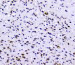 RAD51 Antibody in Immunohistochemistry (Paraffin) (IHC (P))