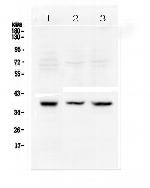 RAD51 Antibody in Western Blot (WB)