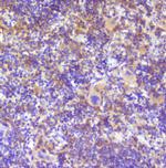 RP2 Antibody in Immunohistochemistry (Paraffin) (IHC (P))