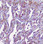 RP2 Antibody in Immunohistochemistry (Paraffin) (IHC (P))