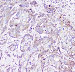 RP2 Antibody in Immunohistochemistry (Paraffin) (IHC (P))