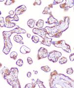 RP2 Antibody in Immunohistochemistry (Paraffin) (IHC (P))