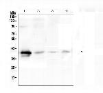 RP2 Antibody in Western Blot (WB)