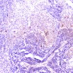 TANK Antibody in Immunohistochemistry (Paraffin) (IHC (P))