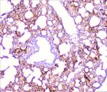 TNFR1 Antibody in Immunohistochemistry (Paraffin) (IHC (P))