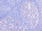 BCL6 Antibody in Immunohistochemistry (Paraffin) (IHC (P))