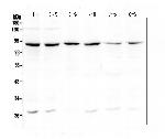 BCL6 Antibody in Western Blot (WB)