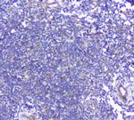 BTLA Antibody in Immunohistochemistry (Paraffin) (IHC (P))