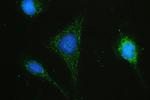 HAS1 Antibody in Immunocytochemistry (ICC/IF)